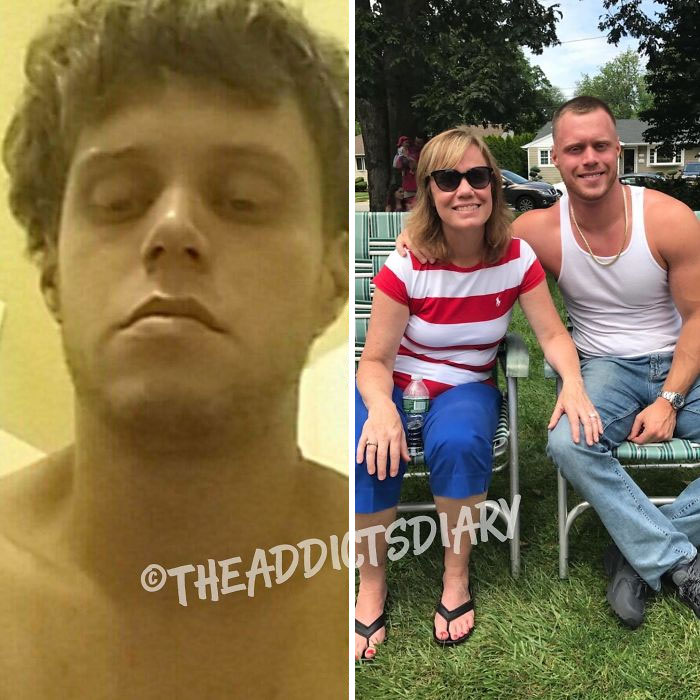 ‘The Addict’s Diary’ Showcases Before & After Transformations Of People Who Quit Drugs (23 New Stories)