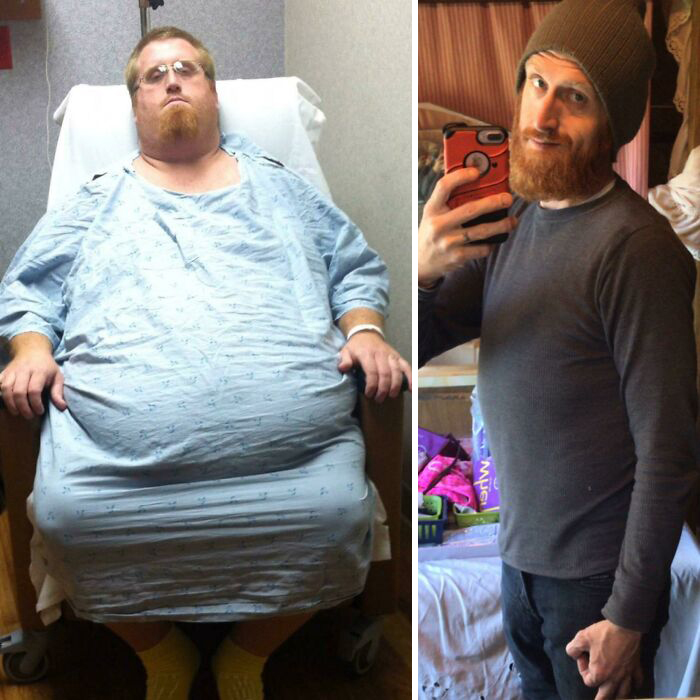 26 Inspiring Body Transformations, As Shared By Determined People In This Online Group