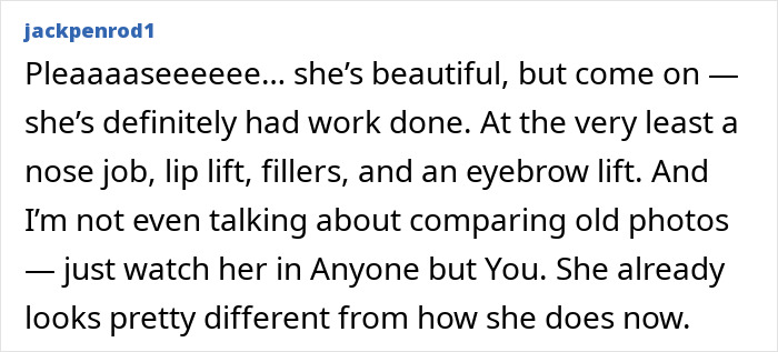 Fans Call Out Sydney Sweeney’s Natural Beauty Claim With Side-By-Side Photos As Evidence