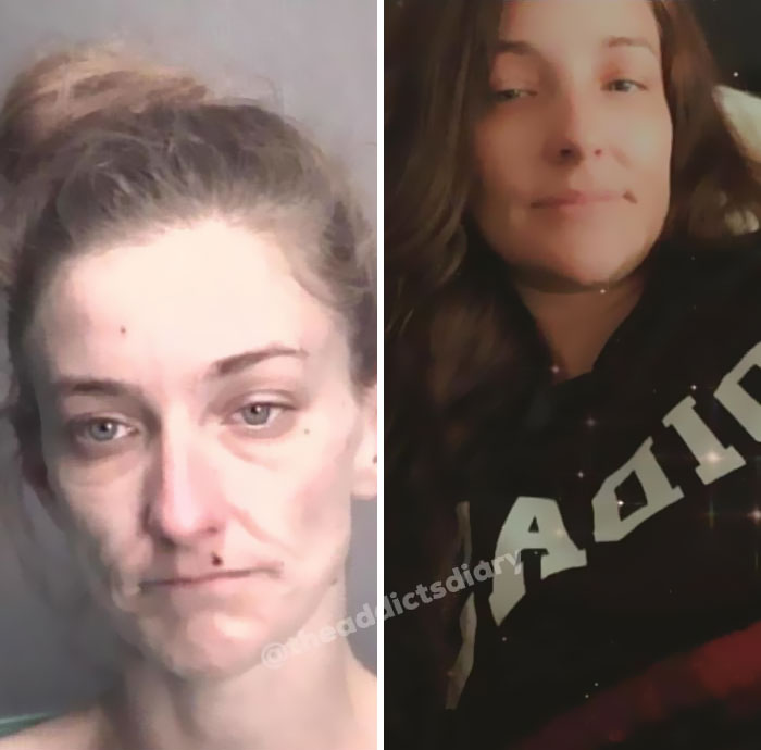 ‘The Addict’s Diary’ Showcases Before & After Transformations Of People Who Quit Drugs (23 New Stories)