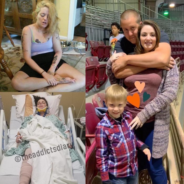 ‘The Addict’s Diary’ Showcases Before & After Transformations Of People Who Quit Drugs (23 New Stories)