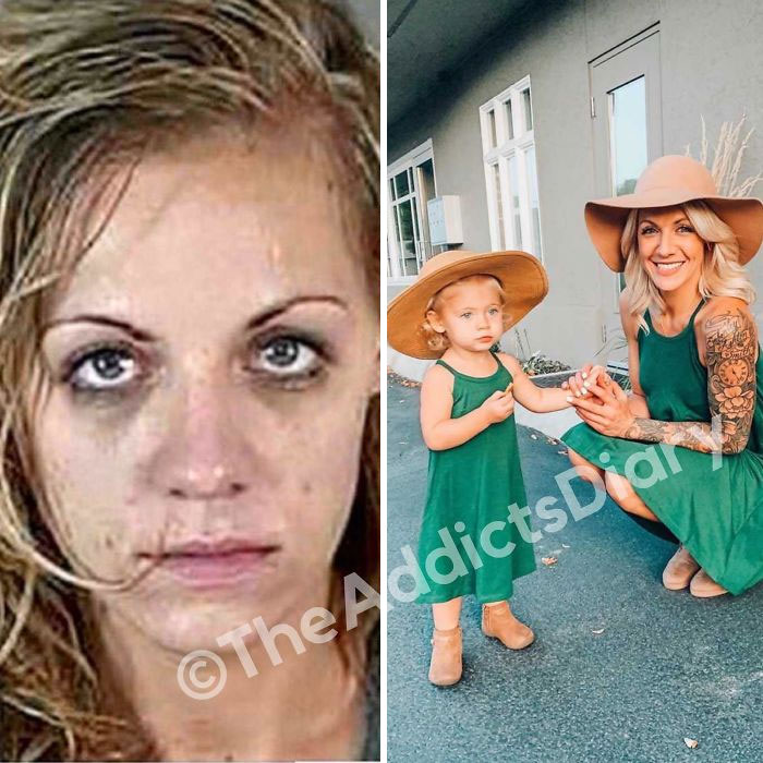 ‘The Addict’s Diary’ Showcases Before & After Transformations Of People Who Quit Drugs (23 New Stories)