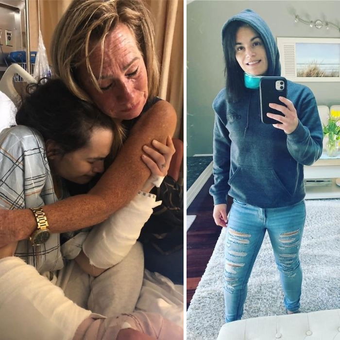 ‘The Addict’s Diary’ Showcases Before & After Transformations Of People Who Quit Drugs (23 New Stories)