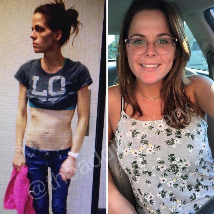 ‘The Addict’s Diary’ Showcases Before & After Transformations Of People Who Quit Drugs (23 New Stories)