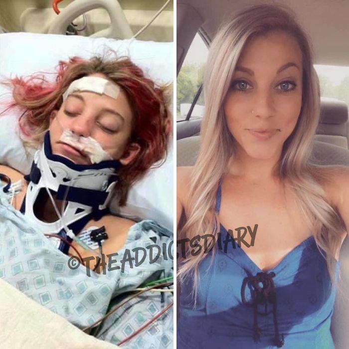 ‘The Addict’s Diary’ Showcases Before & After Transformations Of People Who Quit Drugs (23 New Stories)