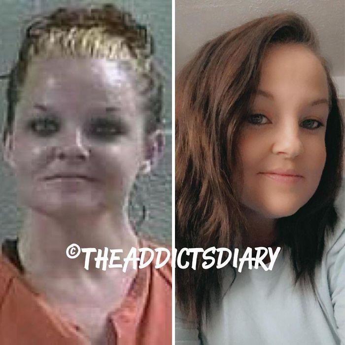 ‘The Addict’s Diary’ Showcases Before & After Transformations Of People Who Quit Drugs (23 New Stories)