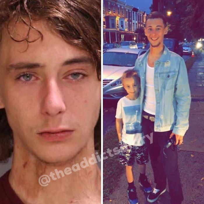 ‘The Addict’s Diary’ Showcases Before & After Transformations Of People Who Quit Drugs (23 New Stories)