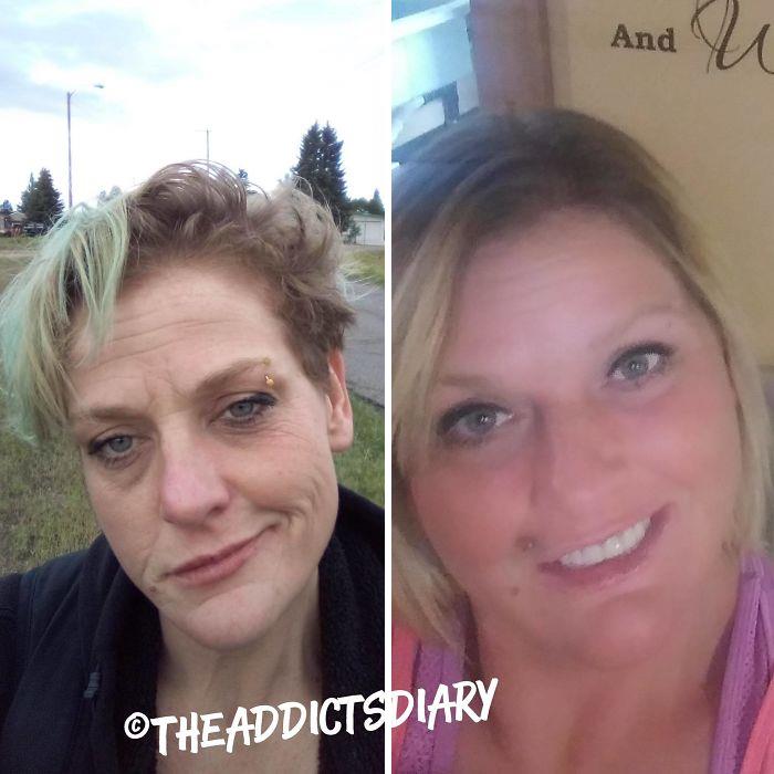‘The Addict’s Diary’ Showcases Before & After Transformations Of People Who Quit Drugs (23 New Stories)