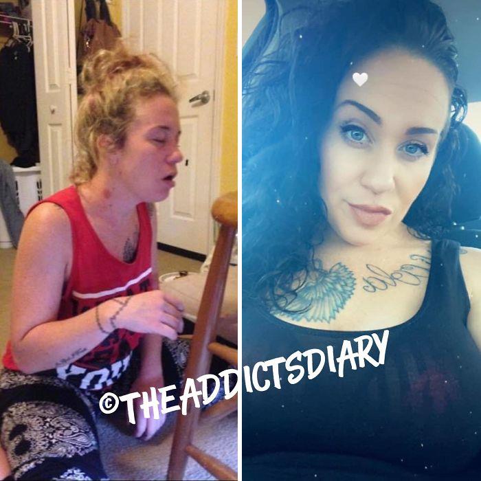 ‘The Addict’s Diary’ Showcases Before & After Transformations Of People Who Quit Drugs (23 New Stories)
